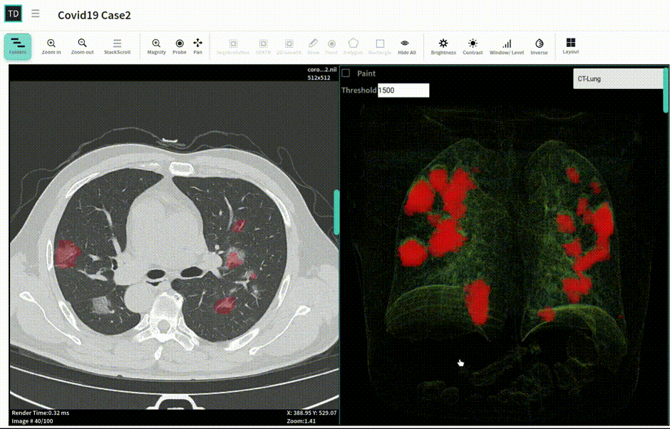 Automatic detection of COVID-19 in chest CT using NVIDIA Clara on TrainingData.io
