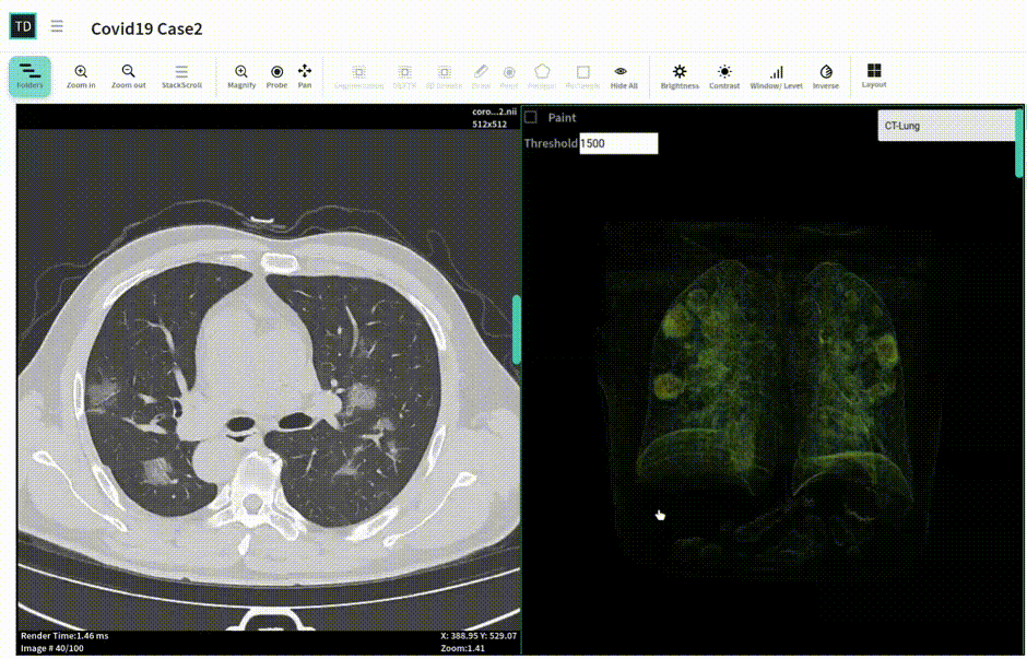 Automatic detection of COVID-19 in chest CT using NVIDIA Clara on TrainingData.io