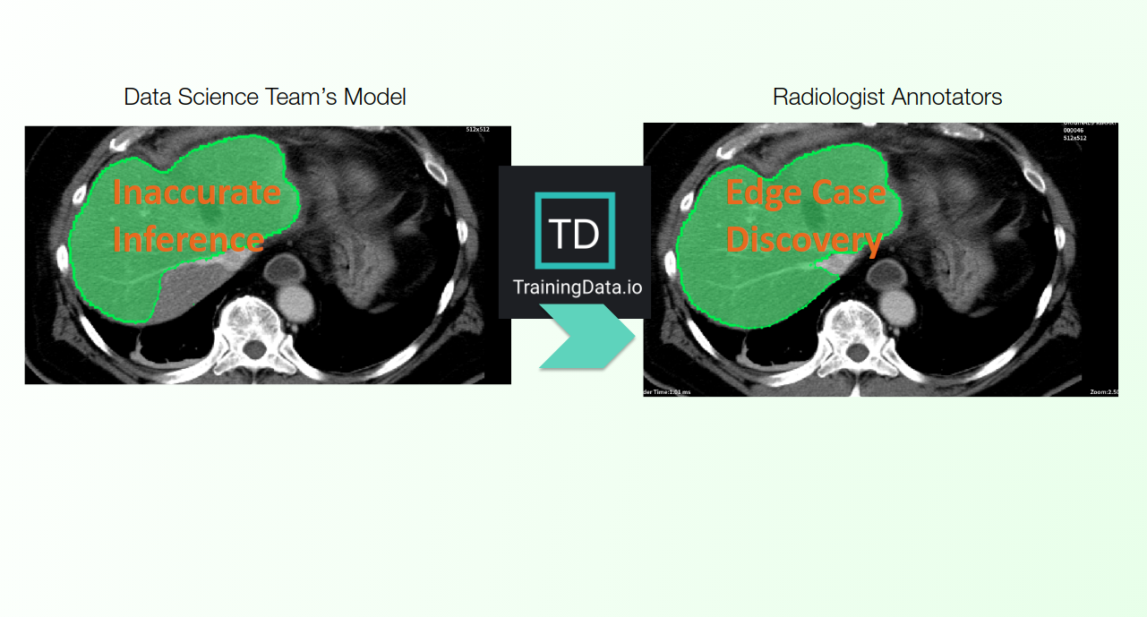 TrainingData.io brings Active Learning Radiology Data Pipeline with NVIDIA Clara