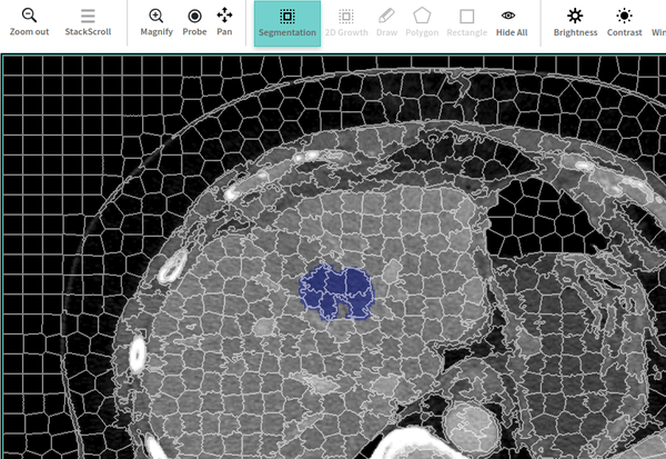 How to Create High Quality Annotated Training Data for Radiology AI?